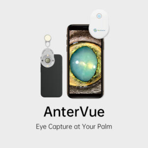 AnterVue